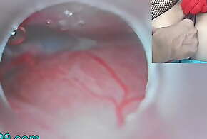 Uncensored Japanese Insemination with Cum into Uterus and Endoscope Camera by Cervix to watch inside womb